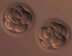 Slider image (8) inSer - Human IVF and Fertility Center